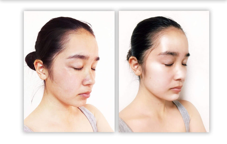 ゴールドピーリングクレーター