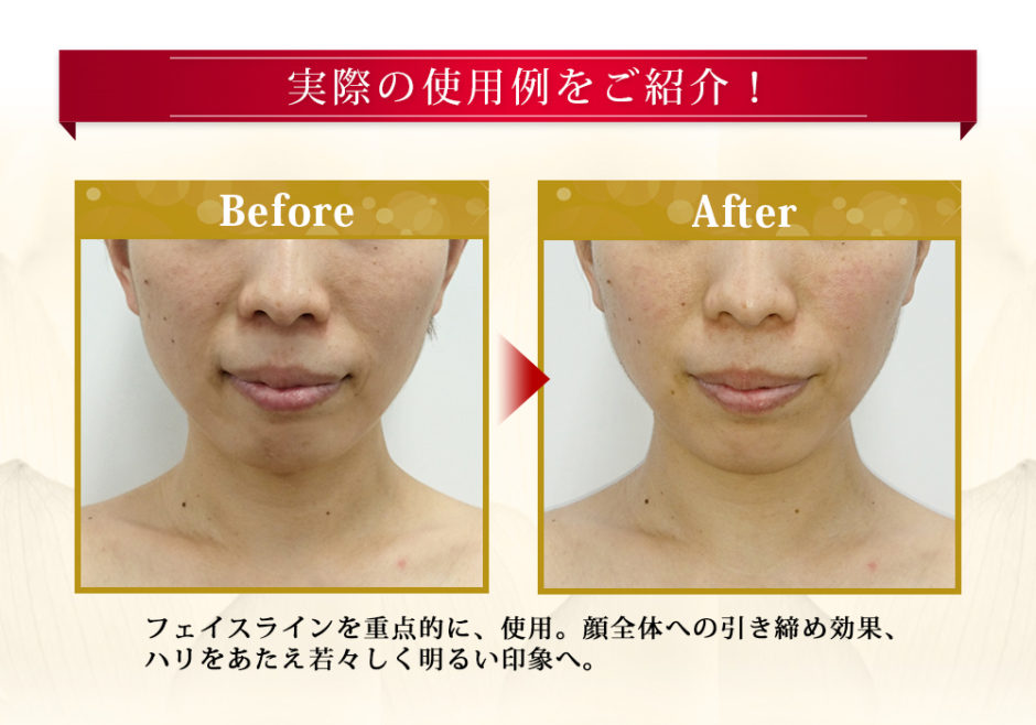 ララルーチュRF